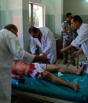 Medics help Ayad Khalid injured in a car bomb explosion, in Baghdad's Yarmouk hospital (AP)