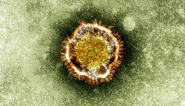 This undated image released by the British Health Protection Agency shows an electron microscope image of a coronavirus, part of a family of viruses that cause ailments including the common cold and SARS, which was first identified last year in the Middle East. (AP Photo/Health Protection Agency)