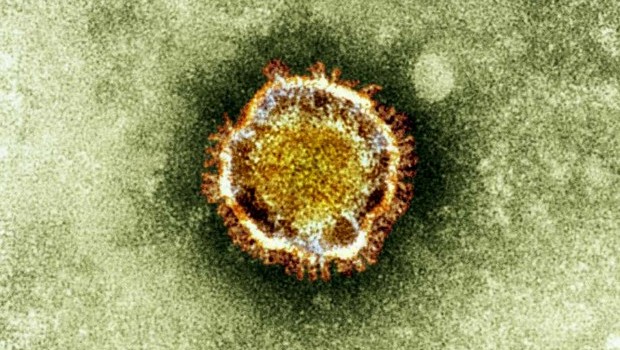 This undated image released by the British Health Protection Agency shows an electron microscope image of a coronavirus, part of a family of viruses that cause ailments including the common cold and SARS, which was first identified last year in the Middle East. (AP Photo/Health Protection Agency)