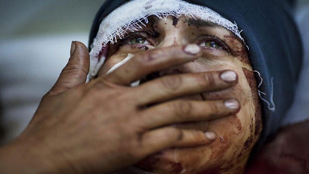 Opinion: Iconic Images of the Syrian War