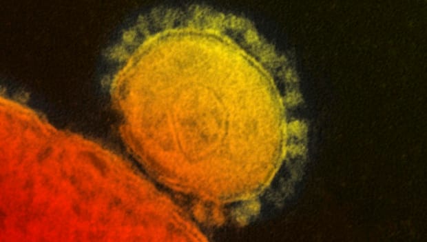 WHO: MERS virus isn’t an emergency—yet