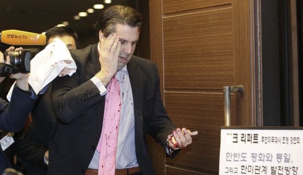 Knife-wielding attacker slashes face of US ambassador in South Korea