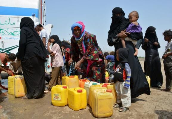 Opinion: Yemen is More Than a War Project
