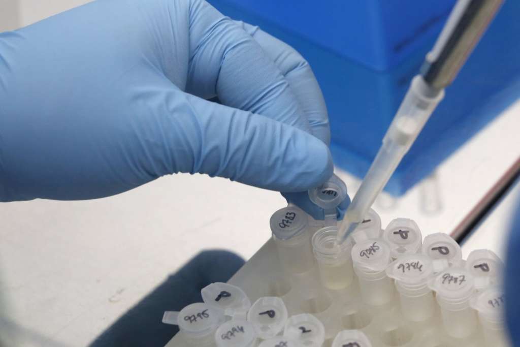 Singapore Urges Tests for Pregnant Women with Zika Signs