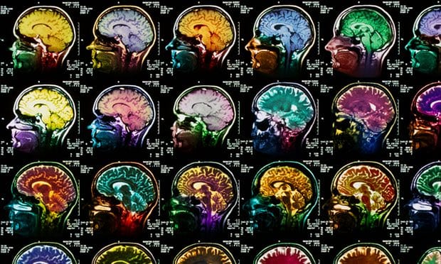 Scientists Detect ‘Hallmark of Dreaming’ in the Brain