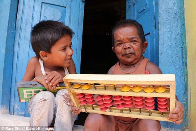 Indian Man at 50 Years Old is Only 29 Inches Tall