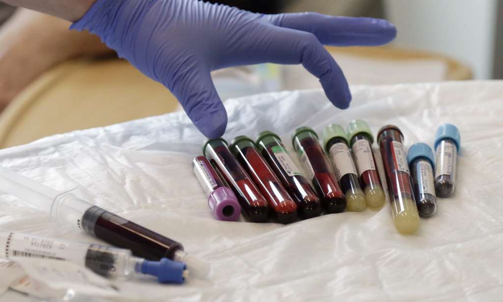 New Drug to Treat Prostate Cancer