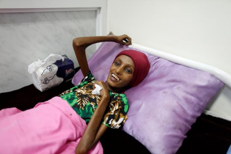 Houthi Militias Shell Al-Thawra Hospital