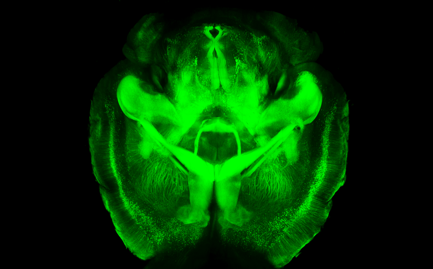 Report Detects Higher Risk of Brain Disease in Football Players
