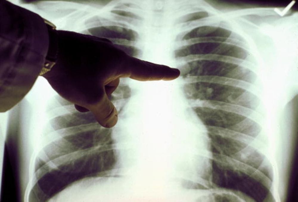 Big Data Shows Big Promise in Medicine