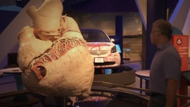 Biggest Heart in the World Preserved in Canadian Museum