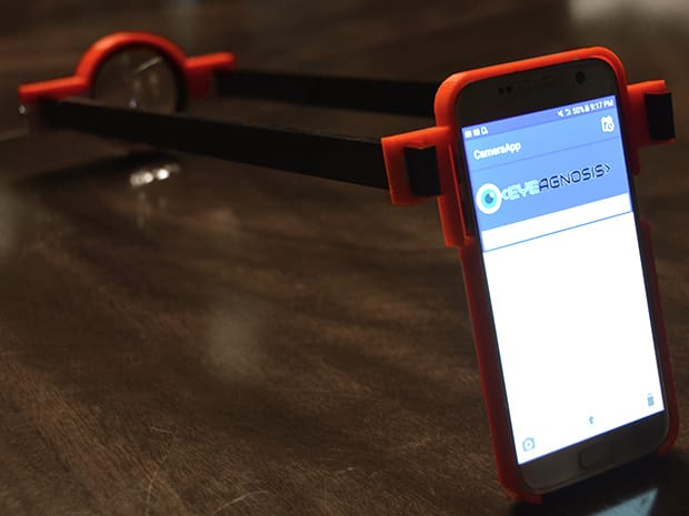 School Students Develop Portable System to Diagnose Eye Diseases