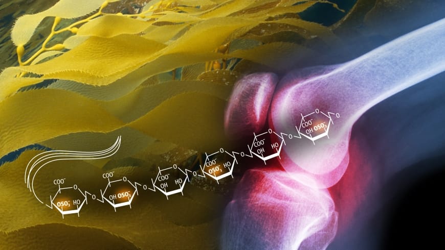 Algae Molecule Found to Treat Arthritis