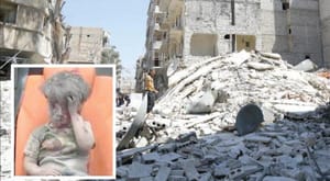 Images of Omran Shock the World and Dominate Global Media