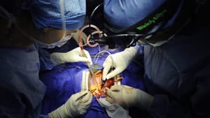 Smart Program to Predict Heart’s Final Beat