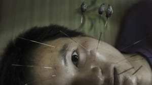 Acupuncture…Another Option to Alleviate Pain