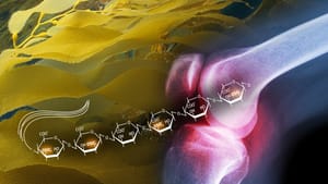 Algae Molecule Found to Treat Arthritis