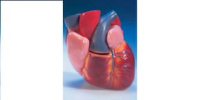 Should You Consider a Coronary Artery Calcium Scan?