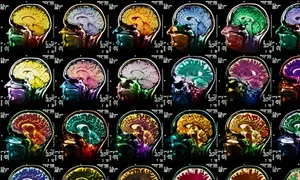 Scientists Detect ‘Hallmark of Dreaming’ in the Brain
