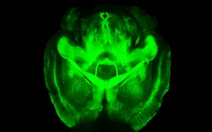Report Detects Higher Risk of Brain Disease in Football Players