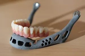 First Successful Jaw Transplant in Turkey